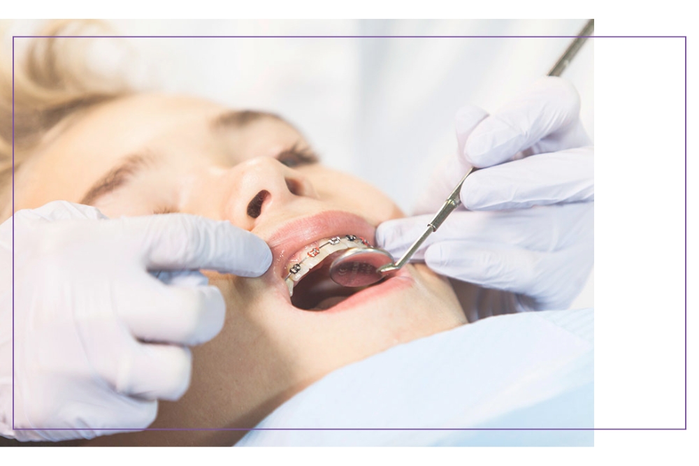 Aparat ortodontyczny Warszawa