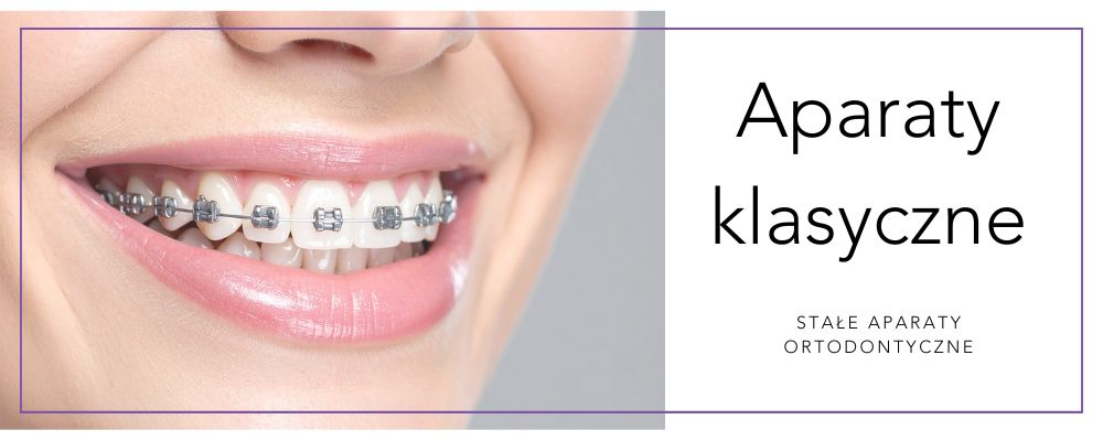 Aparat ortodontyczny klasyczny